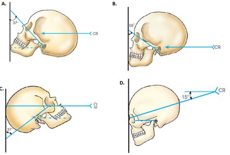 Chapter 11 Cranium Long Merrills Atlas Of Radiographic Positioning