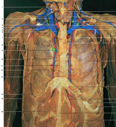 Thoracic Organs Anterior Mediastinum And Pleura Ventral Aspect