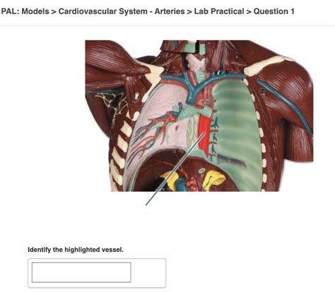 Solved Pal Cadaver Cardiovascular System Blood Vessels Chegg