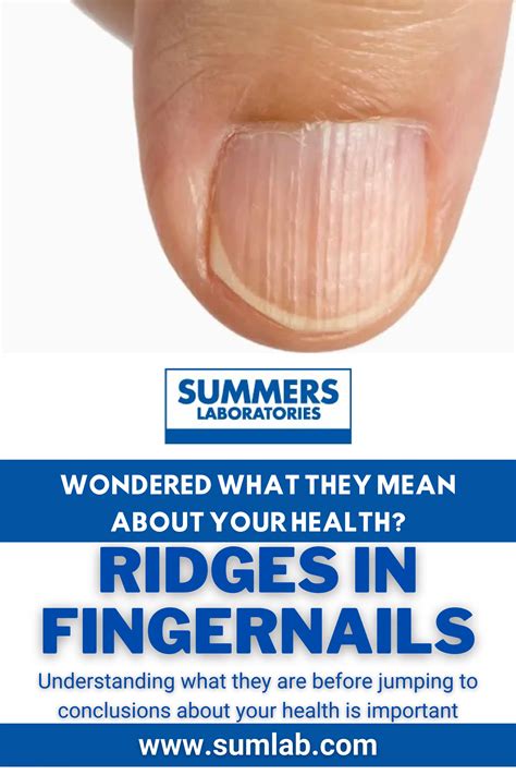 How Can You Get Rid Of Ridges In Your Fingernails Naturally Pdf