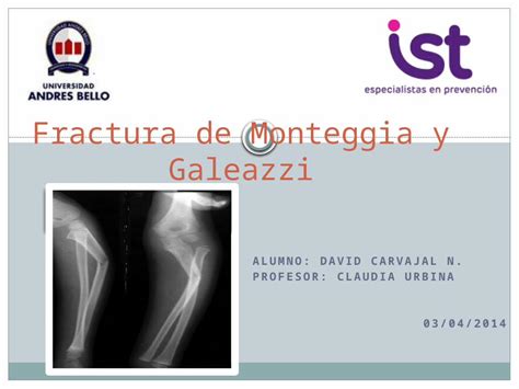 Pptx Caso Clinico Alexis Martinez Modificado Pptx Dokumen Tips The