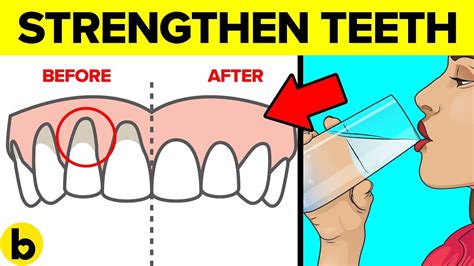 Ways To Strengthen Your Teeth