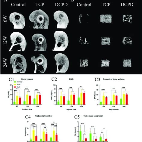 New Bone Formation In Bone Tract A Representative Micro Ct Mip Images