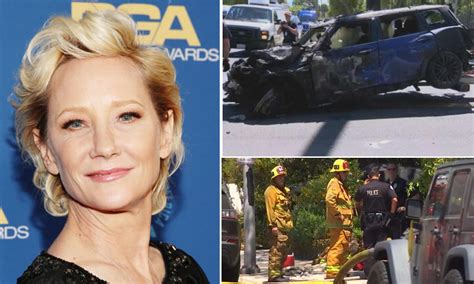 Anne Heche In Coma After A Deadly Car Crash Currently Critical