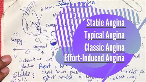 Stable Angina Typical Angina Classic Angina Effort Induced Angina