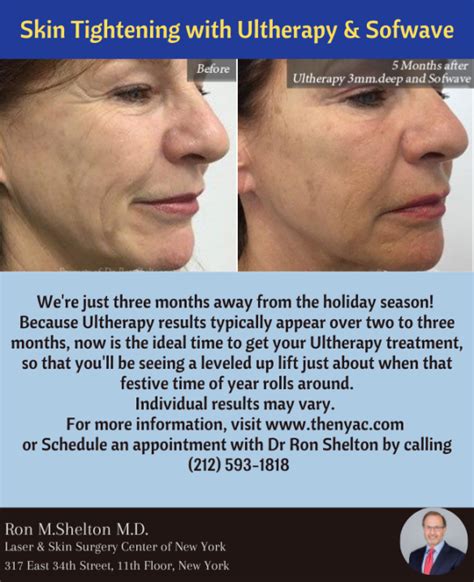 Skin Tightening With Ultherapy And Softwave Dr Ron Shelton