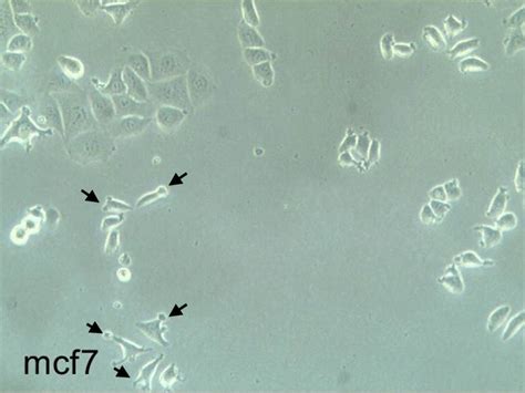 Morphological changes in MCf7 cell line? | ResearchGate