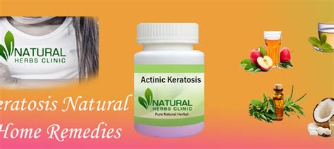 10 Actinic Keratosis Natural Cure And Home Remedies