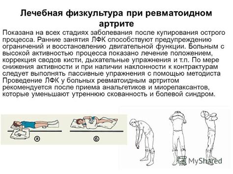 Методика Массажа При Артрите — Buy-artox.ru