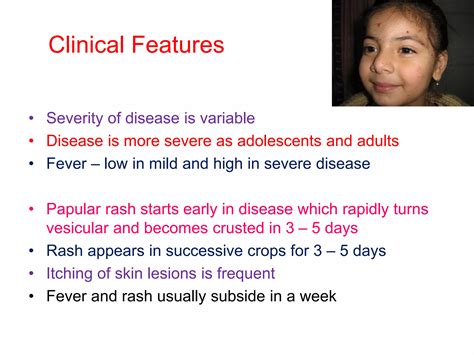 Fever With Vesicular Skin Rash In Children 2021 Ppt