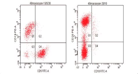 Flow Cytometry Cd 19 And Cd20 Positive B Cell Oligo Monoclonal