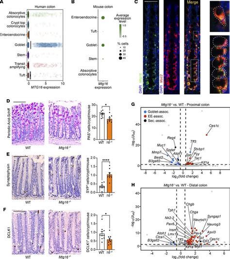 JCI Insight MTG16 Regulates Colonic Epithelial Differentiation