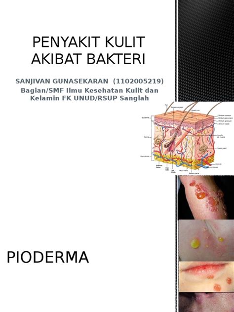 Infeksi Bakteri Kulit Pdf