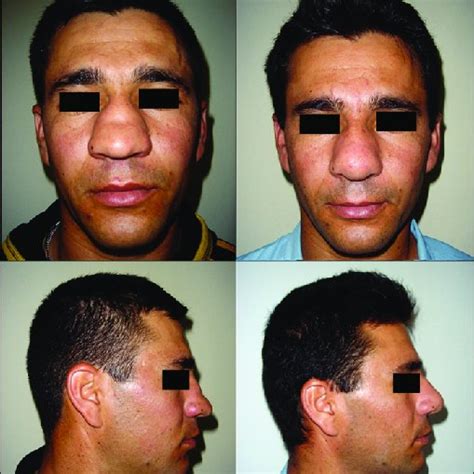 Preoperative Anterior View And Inferior View Of The Patient With