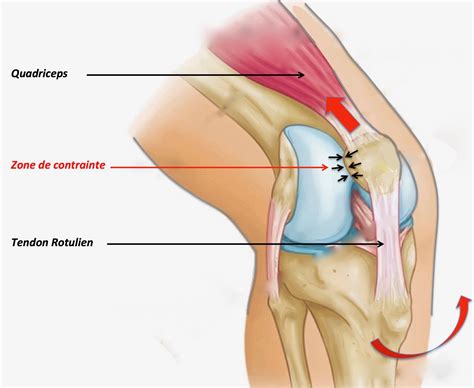 Le Syndrome Rotulien Clinique Ost O Articulaire Des C Dres Grenoble