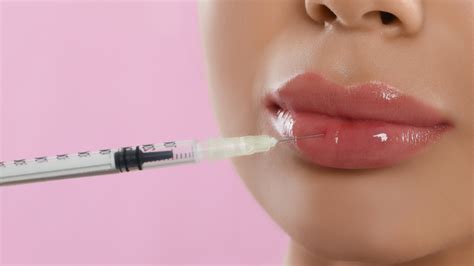 Preenchimento Labial Quanto Tempo Dura Esse Procedimento Danielle