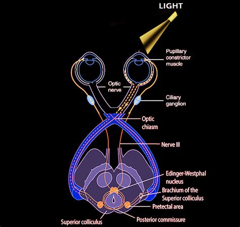 Pupillary Light Reflex Statpearls Ncbi Bookshelf