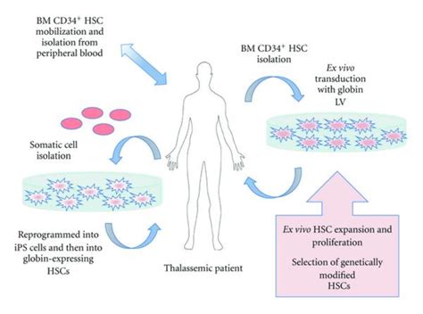 Gene Therapy For Beta-Thalassemia: Updated Perspectives, 42% OFF