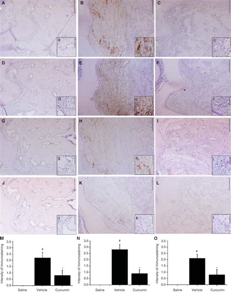 Immunohistochemical Staining For Rankl Rank Opg No Staining For Rankl