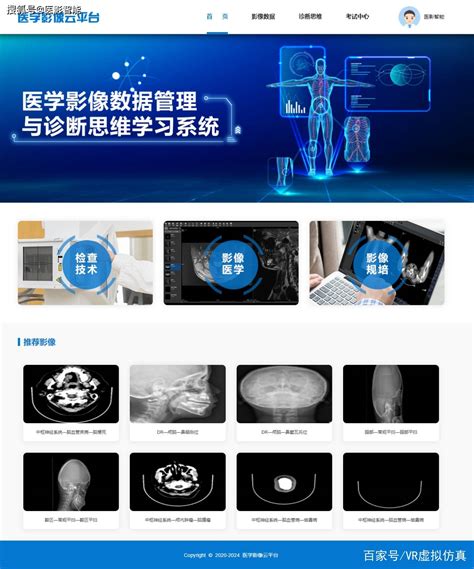 医学影像云平台诊断