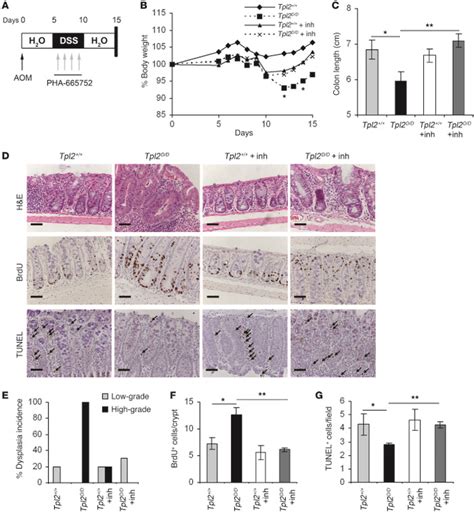 Jci Tpl2 Regulates Intestinal Myofibroblast Hgf Release To Suppress