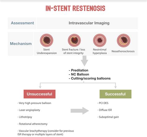 SCAI Expert Consensus Statement On Management Of In Stent Restenosis