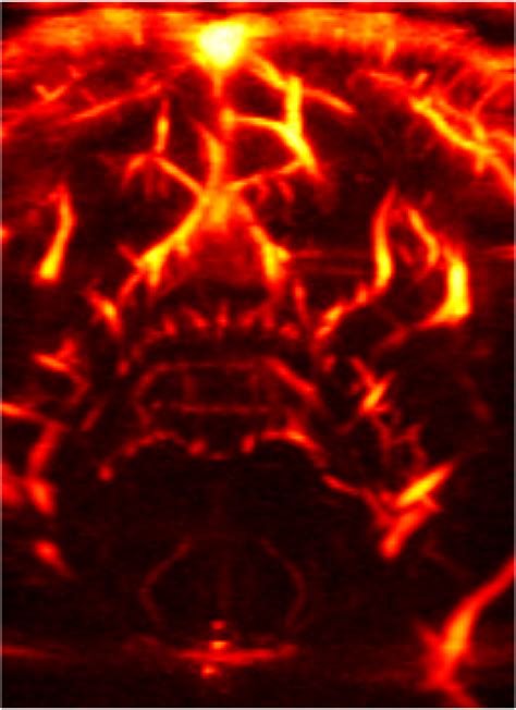 Ultrasound-Based Brain Scanning - SmarAct