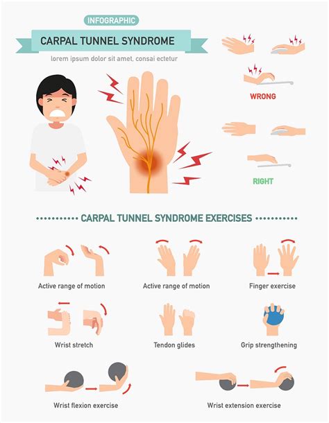 4 Signs and Symptoms of Carpal Tunnel Syndrome