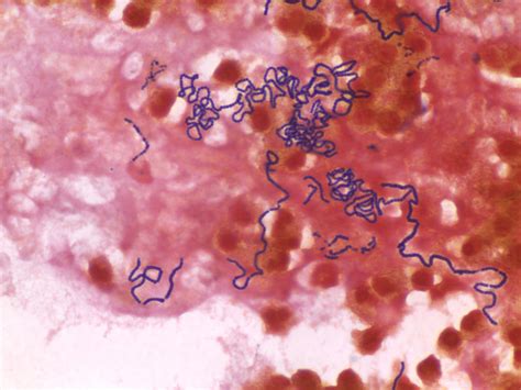 Gram Positive Streptococci