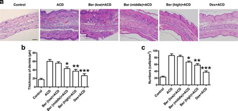 Berberine Inhibits Inflammatory Cell Infiltration Of Ear Skin In The Download Scientific