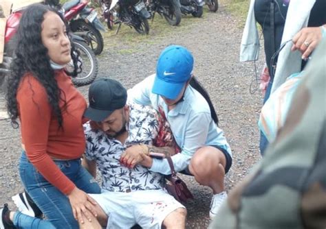 León de El Picacho casi le arranca el brazo a un hombre Diario La Tribuna