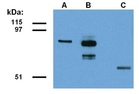 ABRA1 Monoclonal Antibody ABRA1 01 Invitrogen 100 μg Unconjugated