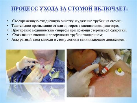 Трахеостома. Трахеостомическая трубка - презентация онлайн
