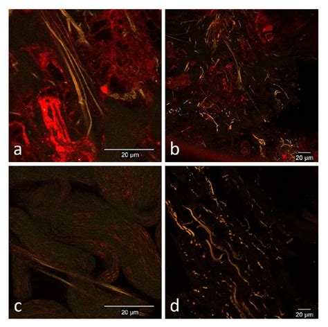 Representative Confocal Microscopy Images Of Normal Skin Of The Limb