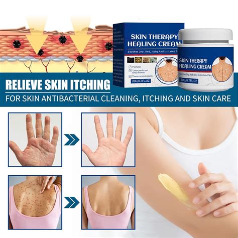 Cream Skin Protectant Skin Cream Skin Psoriasis Cream Soothes Dry