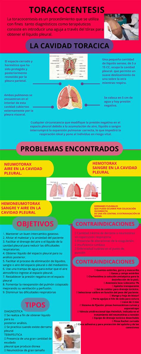 Toracocentesis Pulmonar Esquemas Y Mapas Conceptuales De Ciencias