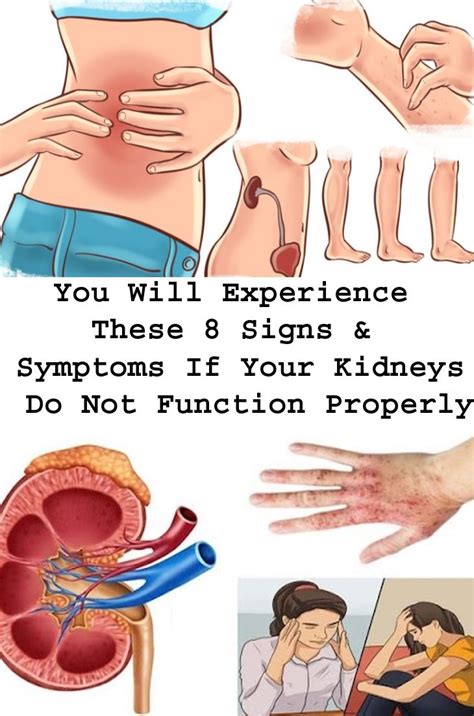 Mga Sintomas Ng May Sakit Sa Kidney