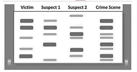 This Is A Dna Fingerprint Exhibiting Samples From A Victim Two