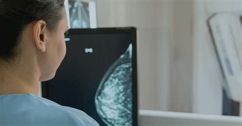 Solis Mammography Tapped By American College Of Radiology For Research