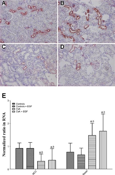 Effect Of Csa On Renal Mrna Expression Levels Of Tight Junction