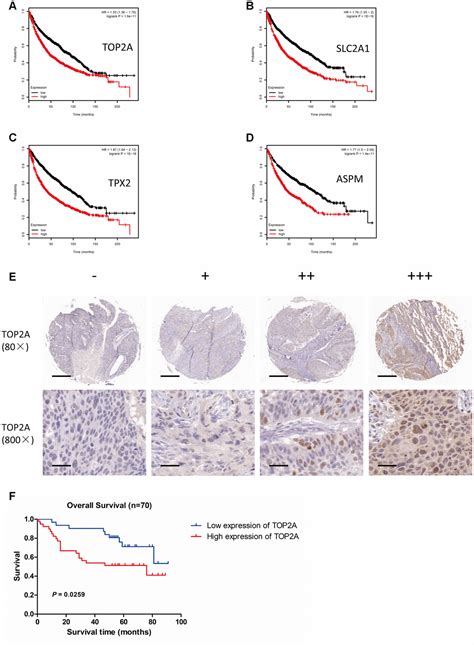 Identification Of Differentially Expressed Genes In Non Small Cell Lung