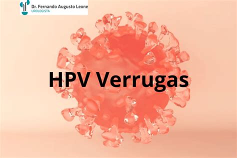 Hpv Verrugas Dr Fernando Leone Urologista Bh Bh