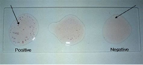 Figure 2 From Development Of Slide Micro Agglutination System For The Rapid Diagnosis Of