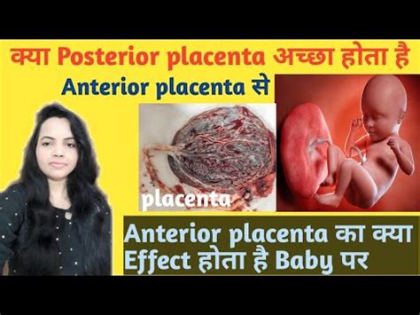 Posterior placenta means Anterior placenta Posterior placenta कय