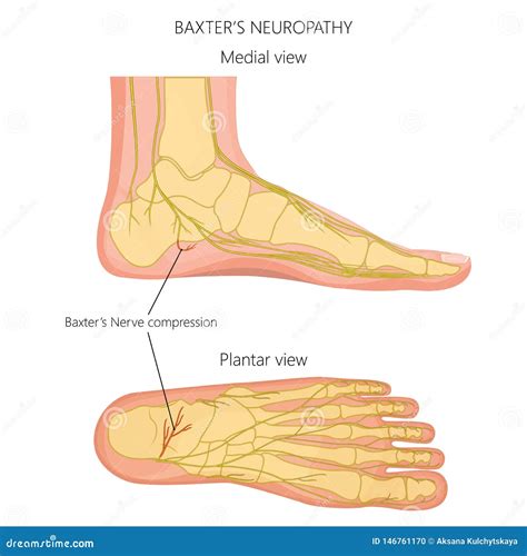 Nerve Diagram Of Foot