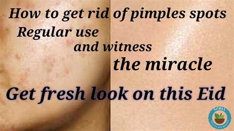 How To Remove Dark Spots From Face How To Remove Pimples Spots