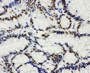 Anti HDAC3 Antibody IHC ICC Flow IF Validated Bosterbio