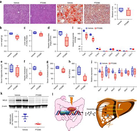 Pt Reverses Hfd Induced Hepatic Steatosis A Representative H E