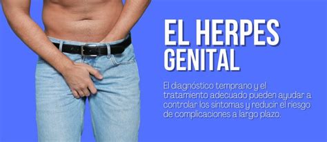 Herpes Genital En Hombres S Ntomas Comunes Y Tratamiento