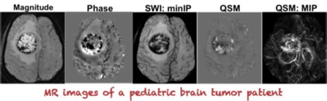 Quantitative Susceptibility Mapping QSM Center For Advanced